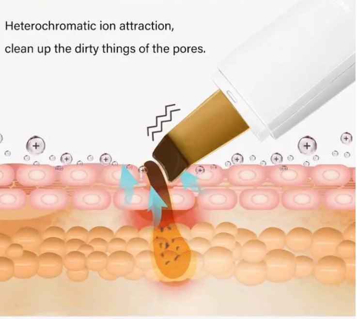 Dispositivo Ultrasónico de Belleza Vexa — Limpieza · Lifting · Iones